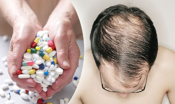 How To Prevent Hair Loss Expert Reveals Best Anti Balding