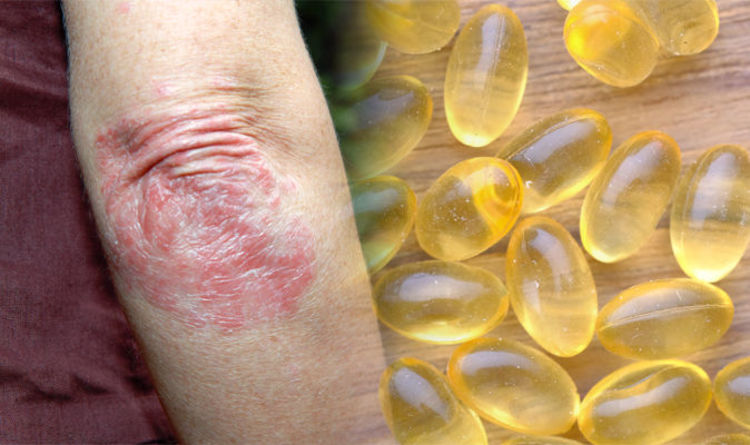 Best Supplements For Skin Omega 3 Can Help Relieve Symptoms
