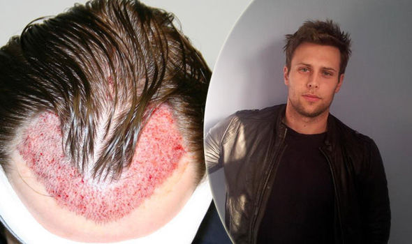 Man Who Spent Thousands On Botched Operations Tells How He