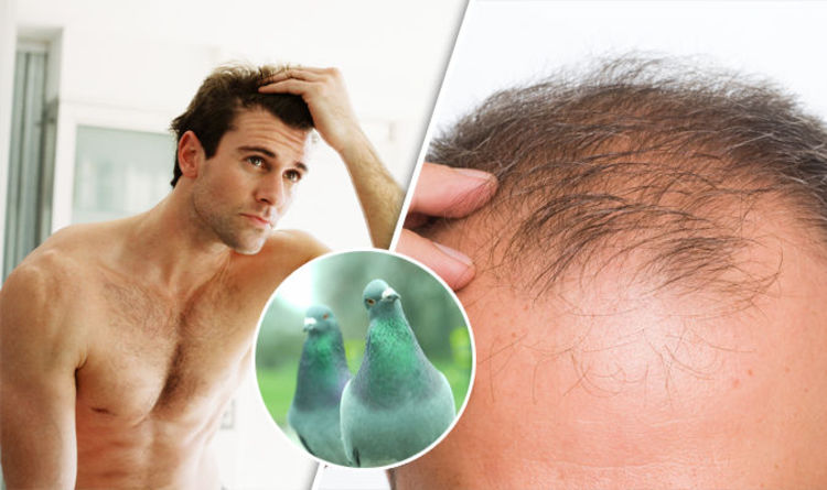 Baldness Cures Men Have Tried Over The Years But Do The Hair