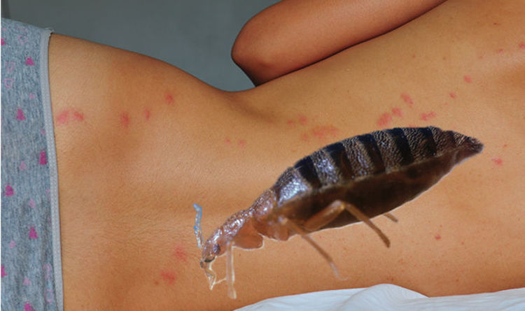 Bed Bugs Four Ways To Prevent Bed Bug Bites And Avoid An