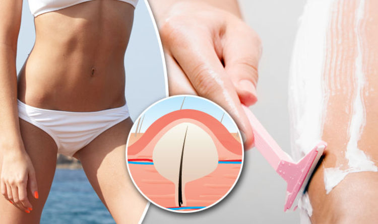 How To Get Rid Of Ingrown Pubic Hair Easy To Use And Natural Home