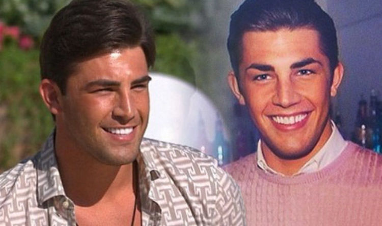 Love Island Instagram Account Jack Fincham Teeth Before Pictures