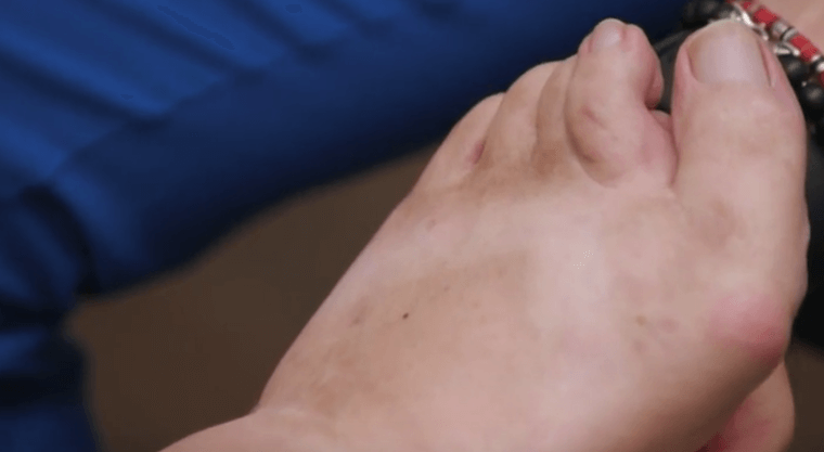 Tlc My Feet Are Killing Me Spoilers Susan Gibbons Frankenstein Feet Daily Soap Dish