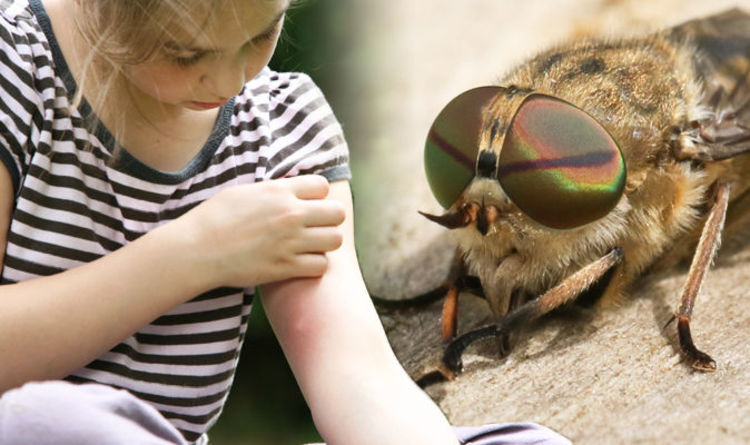 Horsefly Bite Treatment Three Nhs Recommended Ways To Calm