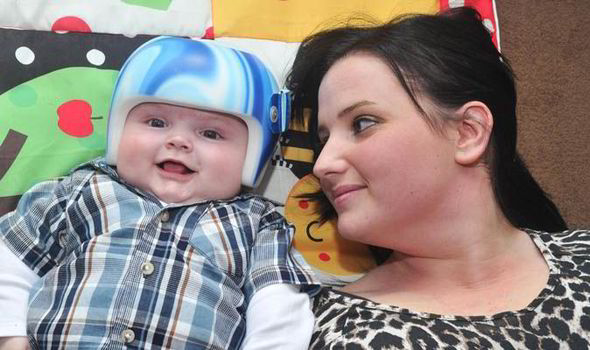 Adorable Baby With Flat Head Syndrome Wears American Football Style